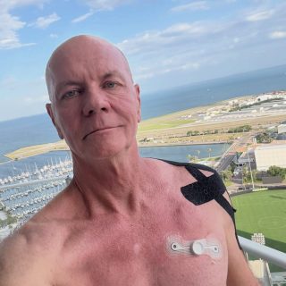 Pacemaker under the skin, seven day Zio Patch heart monitor just below, tape holding the darn shoulder together. Life in the trenches lol. #ageisjustanumber #grateful #recovery